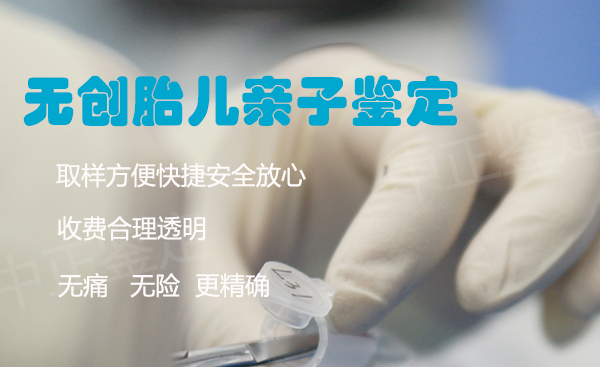 石家庄胎儿和父亲如何做亲子鉴定,石家庄无创孕期亲子鉴定价格收费 石家庄胎儿和父亲如何做亲子鉴定,石家庄无创孕期亲子鉴定价格收费